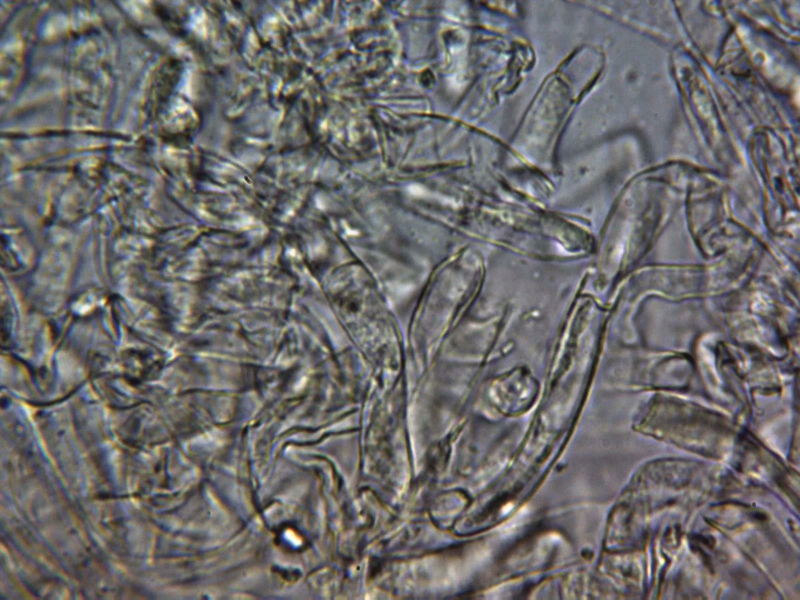 10 - Pileipellis agua